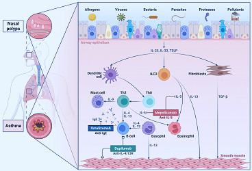 JCM | Free Full-Text | Pathobiology of Type 2 Inflammation in Asthma and Nasal  Polyposis